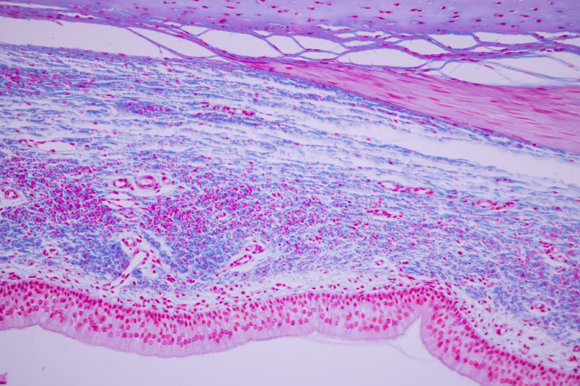 6 Essential Steps to Protect Your Endothelial Glycocalyx Today