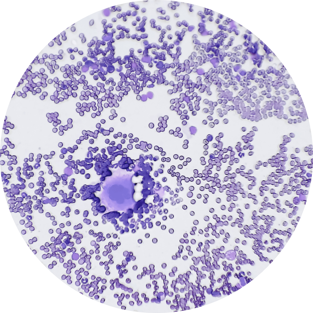 White and red blood cells magnified under microscope